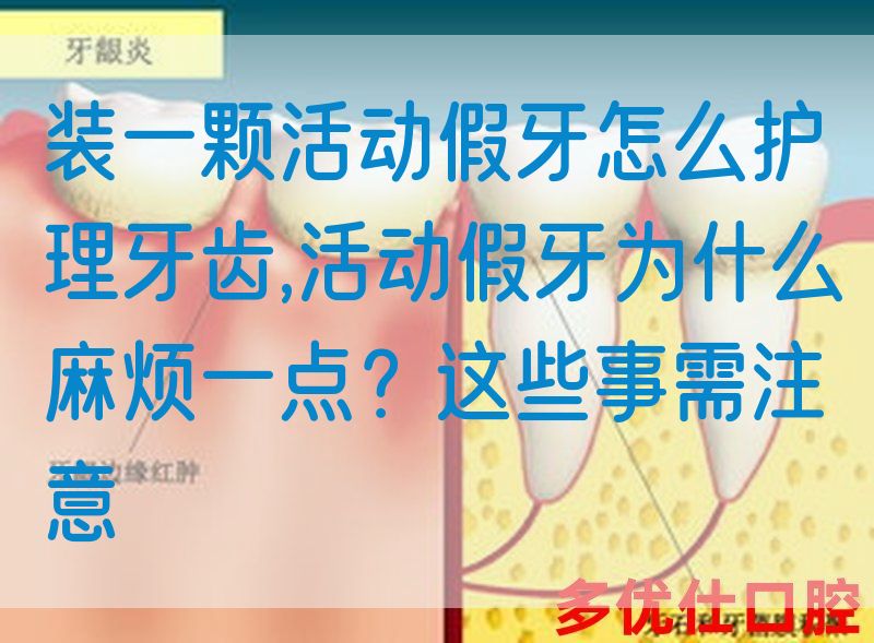 装一颗活动假牙怎么护理牙齿,活动假牙为什么麻烦一点？这些事需注意(图1)
