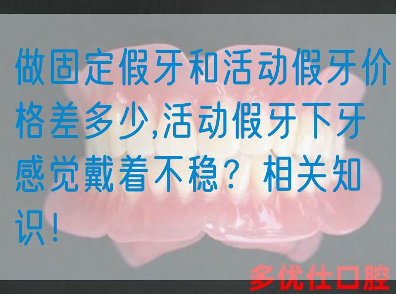 做固定假牙和活动假牙价格差多少,活动假牙下牙感觉戴着不稳？相关知识！(图1)