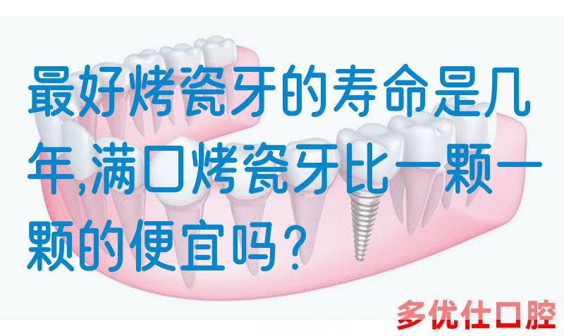 最好烤瓷牙的寿命是几年,满口烤瓷牙比一颗一颗的便宜吗？(图1)