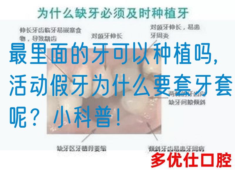 最里面的牙可以种植吗,活动假牙为什么要套牙套呢？小科普！(图1)