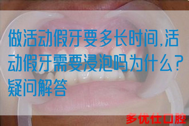 做活动假牙要多长时间,活动假牙需要浸泡吗为什么？疑问解答(图1)