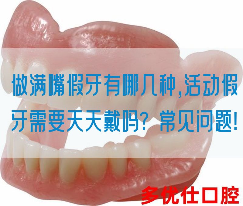 做满嘴假牙有哪几种,活动假牙需要天天戴吗？常见问题！(图1)