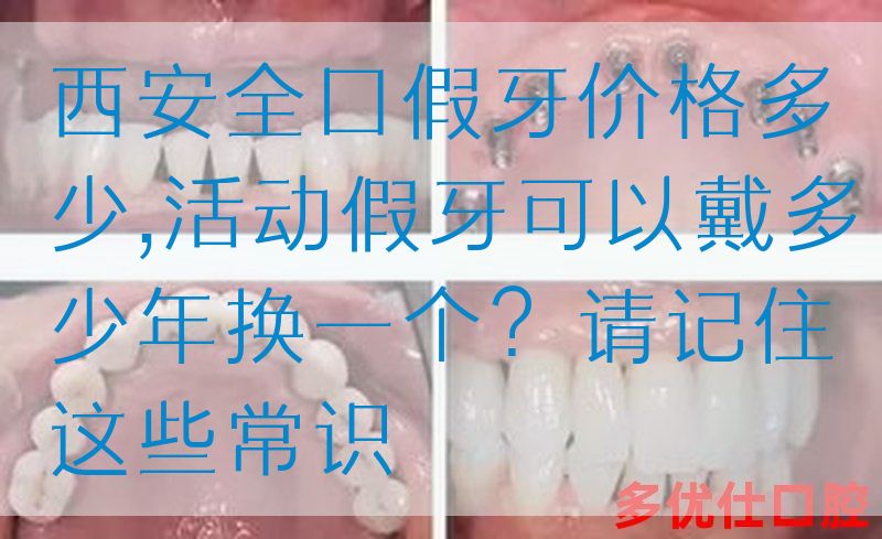 西安全口假牙价格多少,活动假牙可以戴多少年换一个？请记住这些常识(图1)