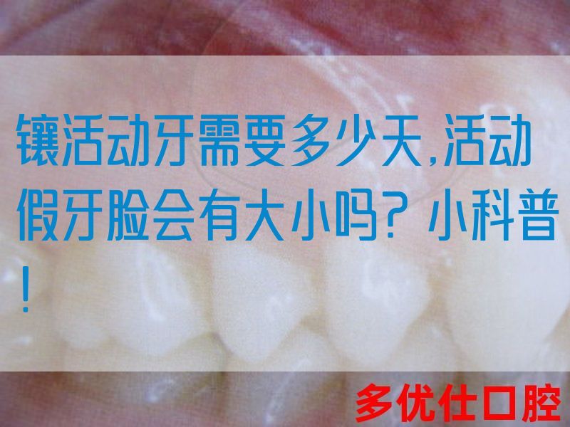 镶活动牙需要多少天,活动假牙*会有大小吗？小科普！(图1)