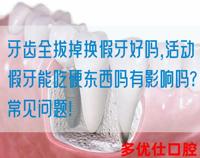 牙齿全拔掉换假牙好吗,活动假牙能吃硬东西吗有影响吗？常见问题！(图1)