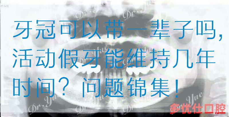 牙冠可以带一辈子吗,活动假牙能维持几年时间？问题锦集！(图1)
