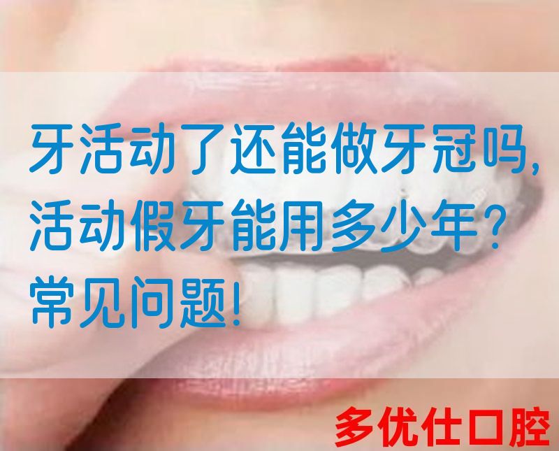 牙活动了还能做牙冠吗,活动假牙能用多少年？常见问题！(图1)