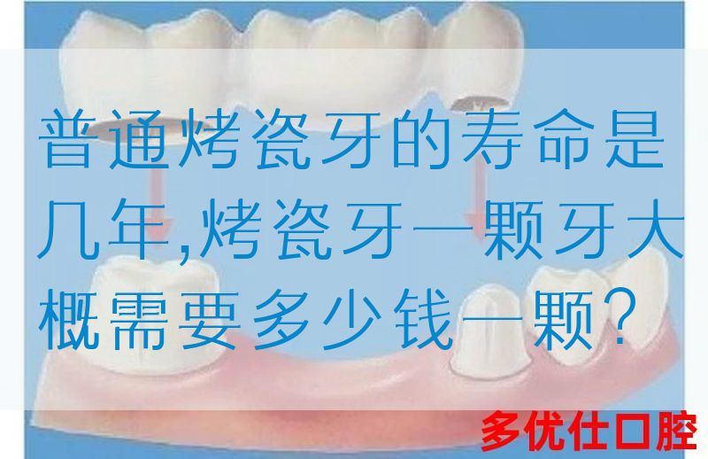 普通烤瓷牙的寿命是几年,烤瓷牙一颗牙大概需要多少钱一颗？(图1)