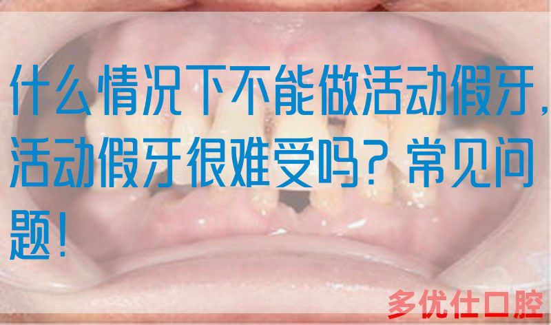 什么情况下不能做活动假牙,活动假牙很难受吗？常见问题！(图1)