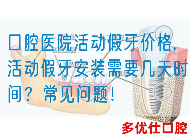 口腔医院活动假牙价格,活动假牙安装需要几天时间？常见问题！(图1)