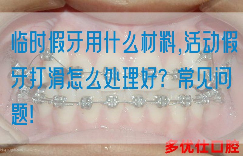 临时假牙用什么材料,活动假牙打滑怎么处理好？常见问题！(图1)