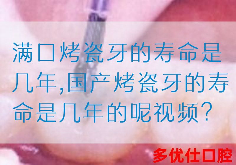 满口烤瓷牙的寿命是几年,国产烤瓷牙的寿命是几年的呢视频？(图1)