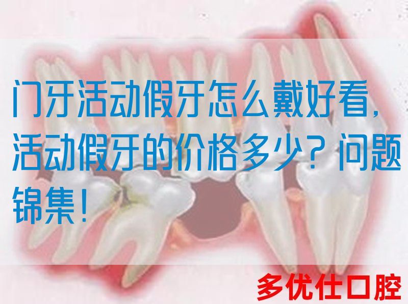 门牙活动假牙怎么戴好看,活动假牙的价格多少？问题锦集！(图1)