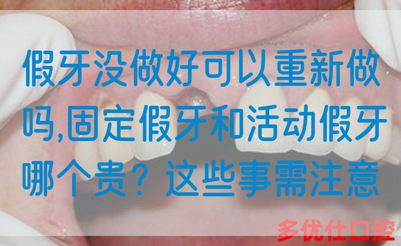 假牙没做好可以重新做吗,固定假牙和活动假牙哪个贵？这些事需注意(图1)