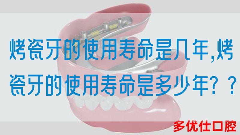 烤瓷牙的使用寿命是几年,烤瓷牙的使用寿命是多少年？？(图1)