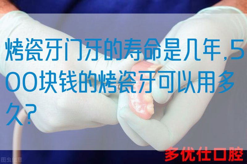 烤瓷牙门牙的寿命是几年,500块钱的烤瓷牙可以用多久？(图1)