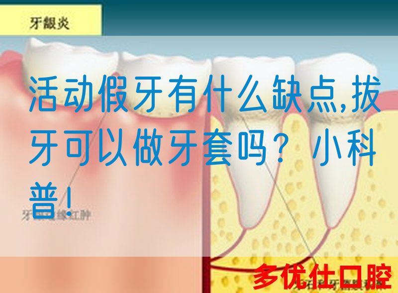 活动假牙有什么缺点,拔牙可以做牙套吗？小科普！(图1)
