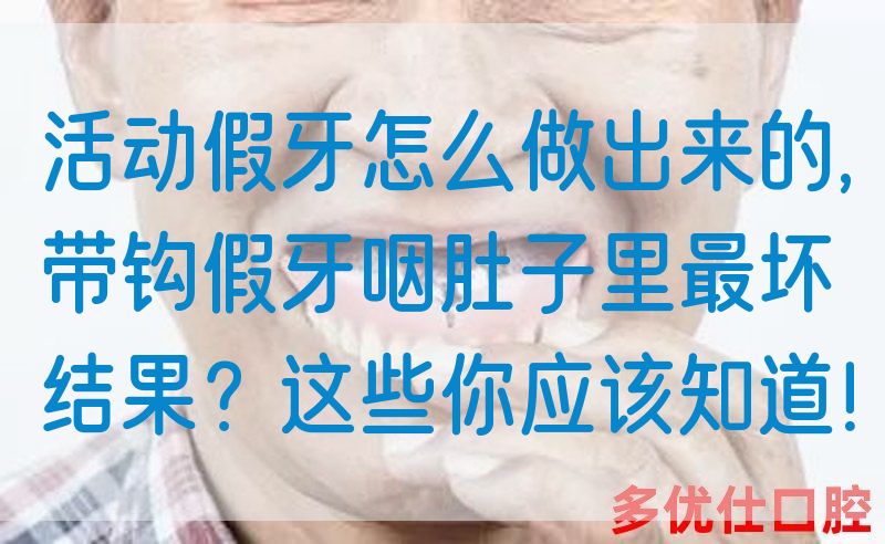 活动假牙怎么做出来的,带钩假牙**子里最坏结果？这些你应该知道！(图1)