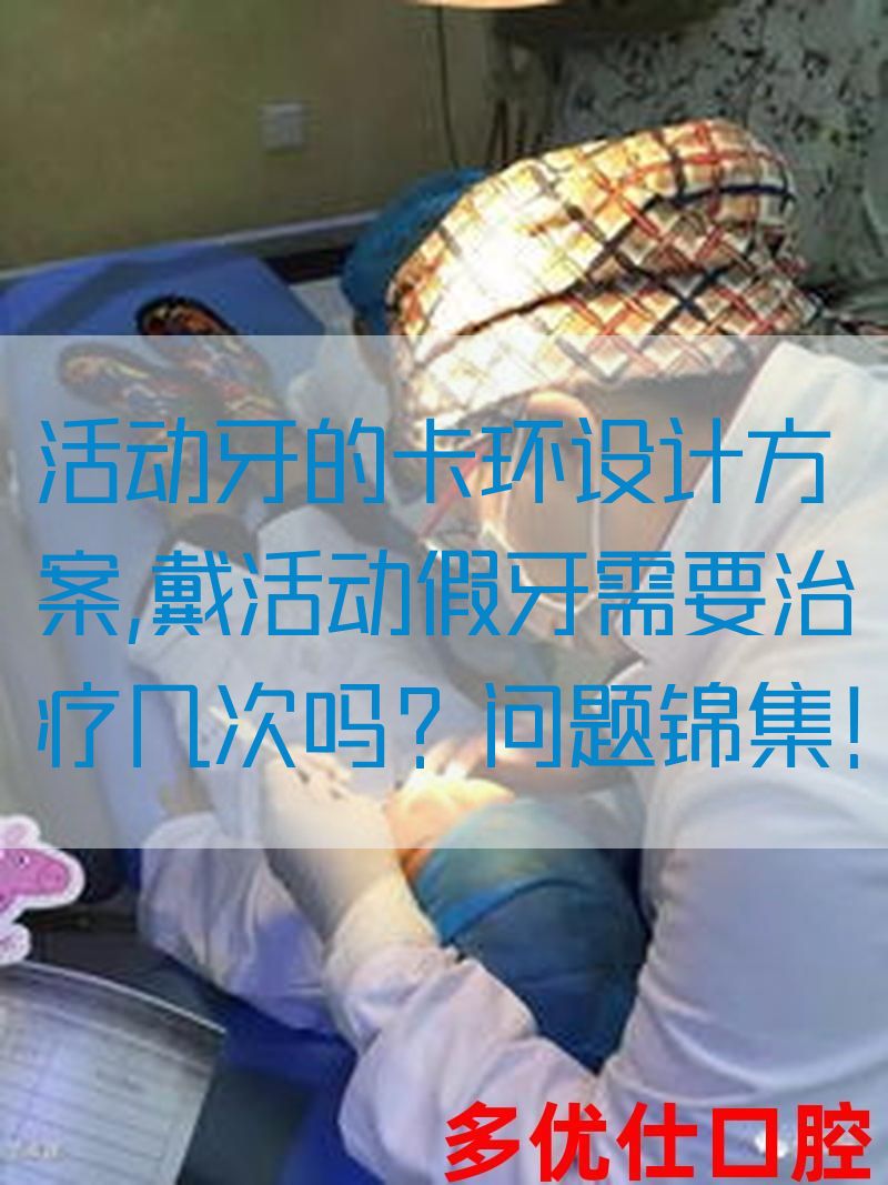 活动牙的卡环设计方案,戴活动假牙需要治疗几次吗？问题锦集！(图1)