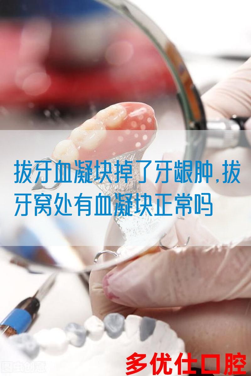 拔牙血凝块掉了牙龈肿,拔牙窝处有血凝块正常吗(图1)