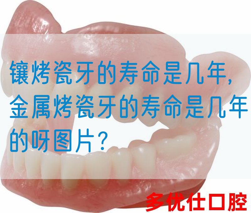 镶烤瓷牙的寿命是几年,金属烤瓷牙的寿命是几年的呀图片？(图1)