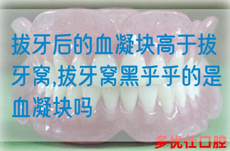拔牙后的血凝块高于拔牙窝,拔牙窝黑乎乎的是血凝块吗(图1)