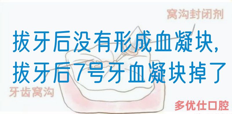 拔牙后没有形成血凝块,拔牙后7号牙血凝块掉了(图1)