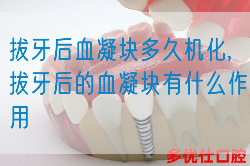 拔牙后血凝块多久机化,拔牙后的血凝块有什么作用(图1)