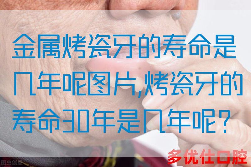 金属烤瓷牙的寿命是几年呢图片,烤瓷牙的寿命30年是几年呢？(图1)