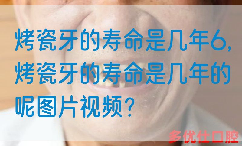 烤瓷牙的寿命是几年6,烤瓷牙的寿命是几年的呢图片视频？(图1)