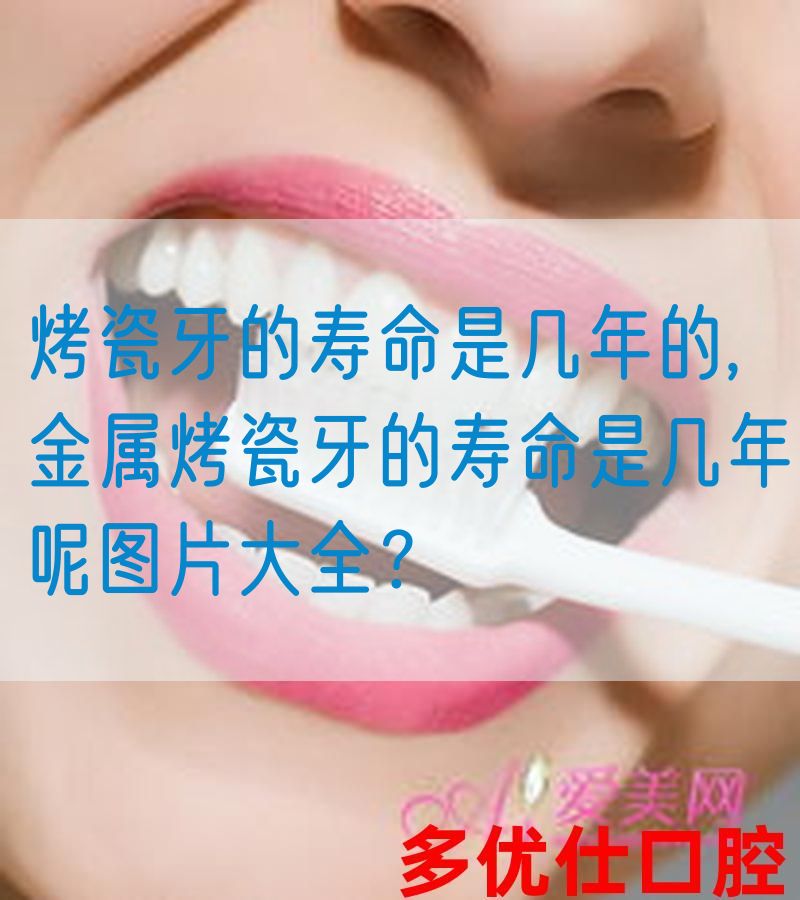 烤瓷牙的寿命是几年的,金属烤瓷牙的寿命是几年呢图片大全？(图1)