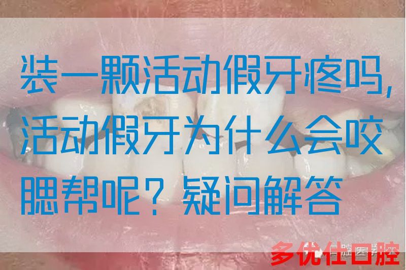 装一颗活动假牙疼吗,活动假牙为什么会咬腮帮呢？疑问解答