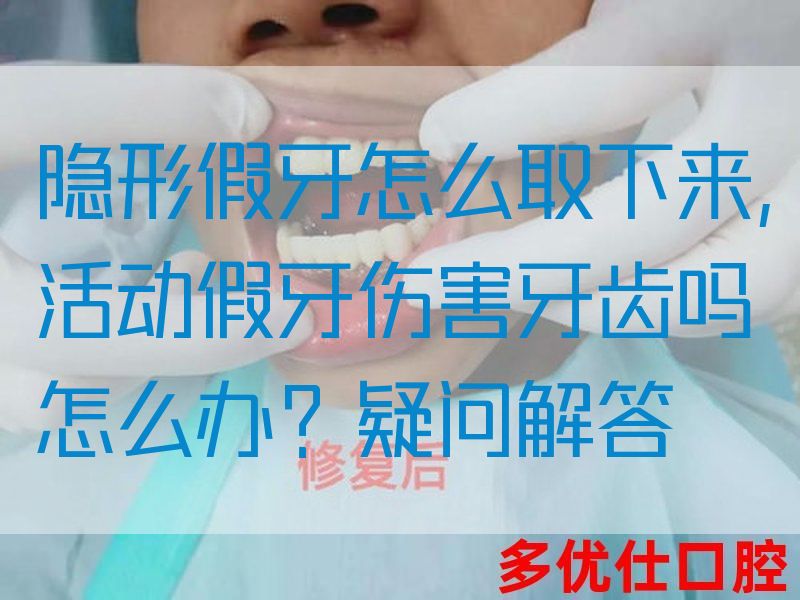 隐形假牙怎么取下来,活动假牙伤害牙齿吗怎么办？疑问解答