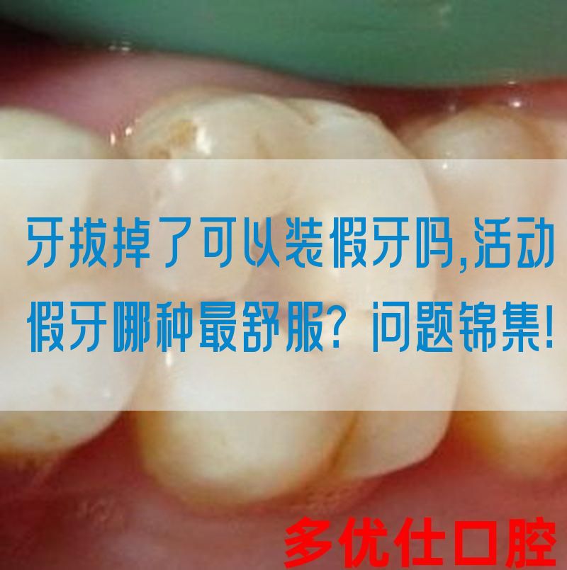 牙拔掉了可以装假牙吗,活动假牙哪种最舒服？问题锦集！
