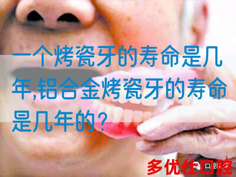 一个烤瓷牙的寿命是几年,铝合金烤瓷牙的寿命是几年的？