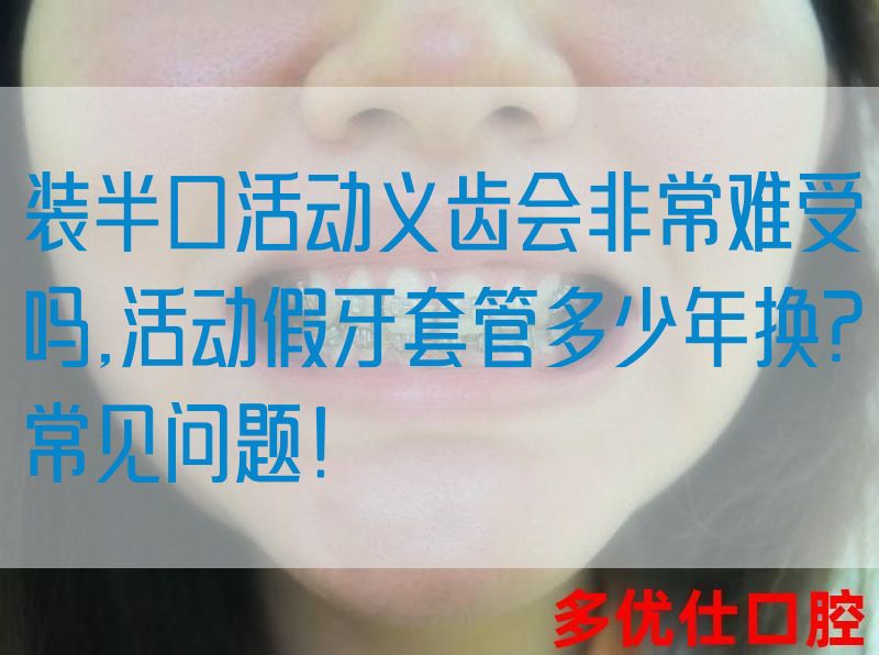 
装半*动义齿会非常难受吗,活动假牙套管多少年换?常见问题！