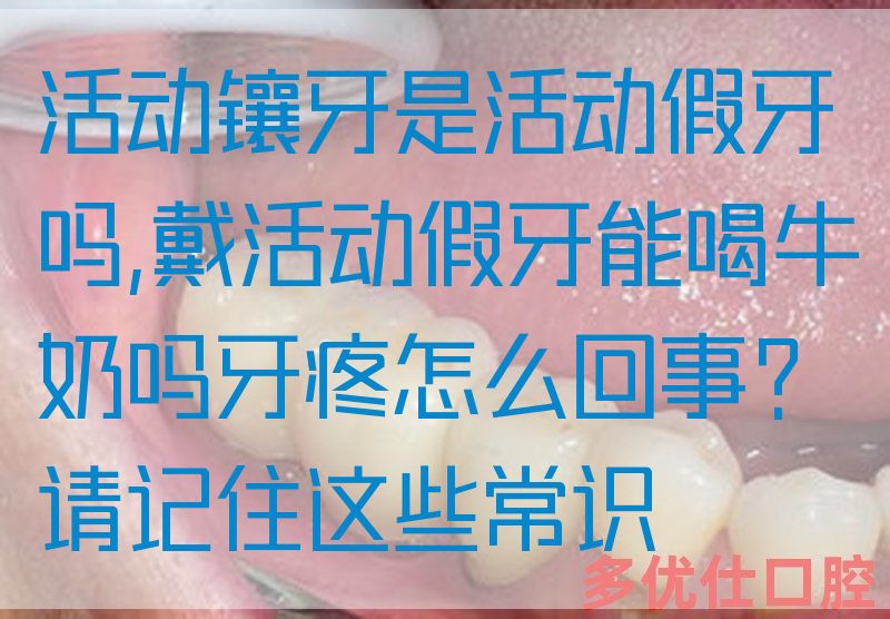 活动镶牙是活动假牙吗,戴活动假牙能喝牛奶吗牙疼怎么回事？请记住这些常识