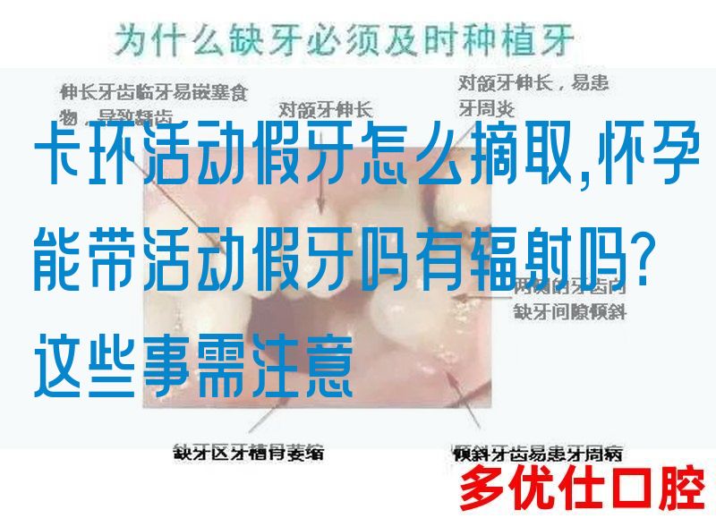 卡环活动假牙怎么摘取,怀孕能带活动假牙吗有辐射吗？这些事需注意