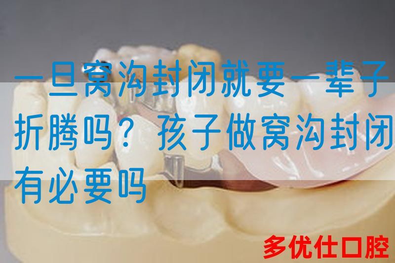 一旦窝沟封闭就要一辈子折腾吗？孩子做窝沟封闭有必要吗(图1)