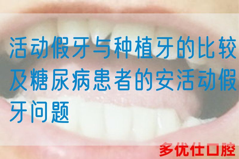 活动假牙与种植牙的比较及糖*病患者的安活动假牙问题(图1)