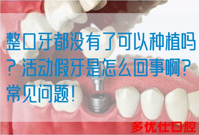 整口牙都没有了可以种植吗？活动假牙是怎么回事啊？常见问题！(图1)