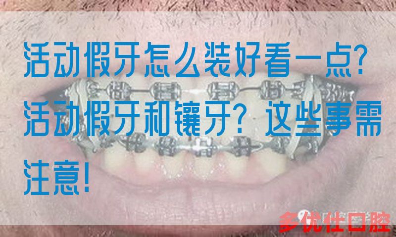 活动假牙怎么装好看一点？活动假牙和镶牙？这些事需注意！(图1)