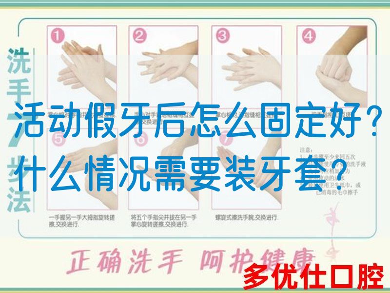 活动假牙后怎么固定好？什么情况需要装牙套？(图1)