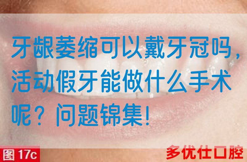 牙龈萎缩可以戴牙冠吗，活动假牙能做什么手术呢？问题锦集！(图1)