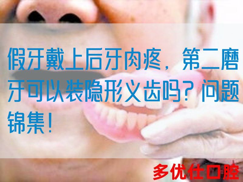 假牙戴上后牙肉疼，第二磨牙可以装隐形义齿吗？问题锦集！