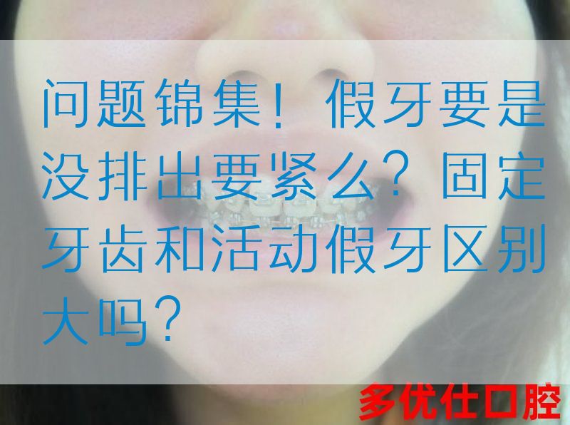 问题锦集！假牙要是没排出要紧么？固定牙齿和活动假牙区别大吗？(图1)