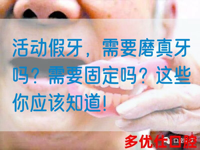 活动假牙，需要磨真牙吗？需要固定吗？这些你应该知道！(图1)