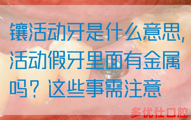 镶活动牙是什么意思,活动假牙里面有金属吗？这些事需注意