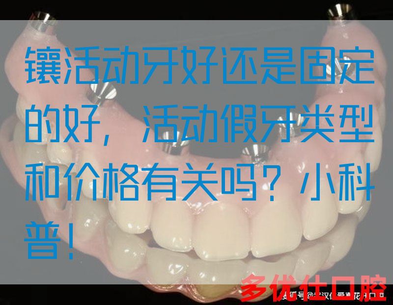 镶活动牙好还是固定的好，活动假牙类型和价格有关吗？小科普！