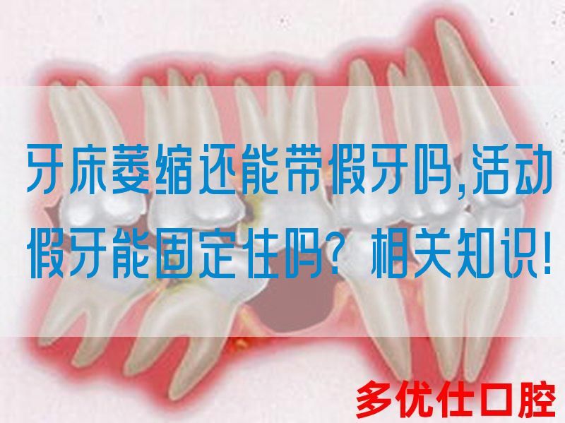牙*萎缩还能带假牙吗,活动假牙能固定住吗？相关知识！